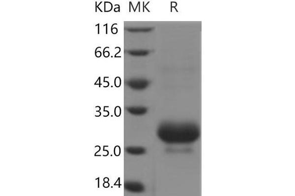 CTHRC1 Protein (His tag)