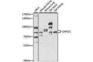 Western blot analysis of extracts of various cell lines, using ZNF131 antibody. (ZNF131 Antikörper)