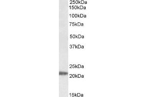 Western Blotting (WB) image for anti-IMP3, U3 Small Nucleolar Ribonucleoprotein (IMP3) antibody (ABIN5935464) (IMP3 Antikörper)