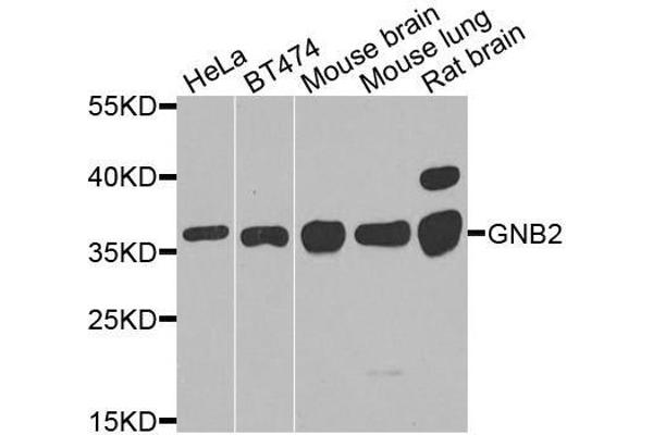 GNB2 Antikörper  (AA 1-340)