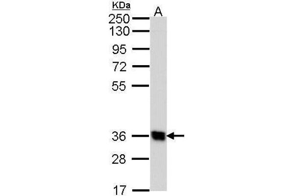 GPR62 Antikörper  (N-Term)