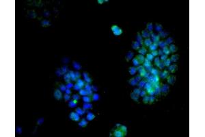 Immunofluorescence (Cultured Cells) (IF (cc)) image for anti-Cyclin D2 (CCND2) (AA 161-288) antibody (ABIN738366)