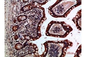 Immunohistochemical analysis of paraffin-embedded human-small-intestine, antibody was diluted at 1:200. (GREM2 Antikörper  (AA 71-120))