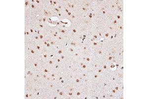 Immunohistochemistry of paraffin-embedded rat brain using RBM3 antibody  at dilution of 1:100 (40x lens). (RBM3 Antikörper  (AA 1-157))