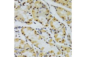 Immunohistochemistry of paraffin-embedded human stomach using ALYREF antibody (ABIN5973579) at dilution of 1/100 (40x lens). (THO Complex 4 Antikörper)