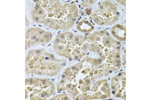 Immunohistochemistry of paraffin-embedded human kidney using GALNT2 Antibody (ABIN5974158) at dilution of 1/100 (40x lens). (GALNT2 Antikörper)