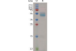 Human HBEGF Protein, hFc Tag on SDS-PAGE under reducing condition. (HBEGF Protein (AA 20-160) (Fc Tag))