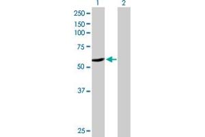 Western Blot analysis of CYP2A6 expression in transfected 293T cell line by CYP2A6 MaxPab polyclonal antibody. (CYP2A6 Antikörper  (AA 1-494))