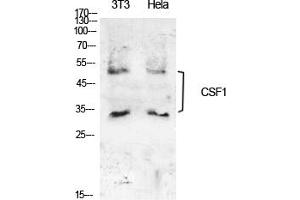 Western Blot analysis of NIH-3T3, hela cells using M-CSF Polyclonal Antibody. (M-CSF/CSF1 Antikörper  (C-Term))