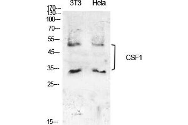 M-CSF/CSF1 Antikörper  (C-Term)