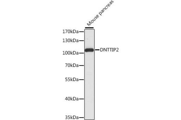 DNTTIP2 Antikörper  (AA 1-300)