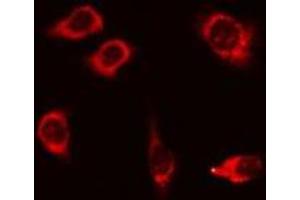 ABIN6275885 staining 293 cells by IF/ICC. (Desmoglein 1 Antikörper  (N-Term))