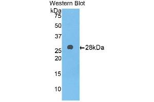 Detection of Recombinant a1BG, Rat using Monoclonal Antibody to Alpha-1-B-Glycoprotein (a1BG) (A1BG Antikörper  (AA 220-415))