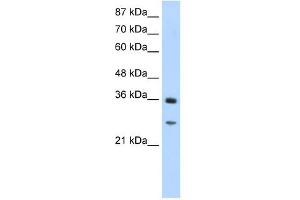 GIPC2 antibody used at 1. (GIPC2 Antikörper  (N-Term))