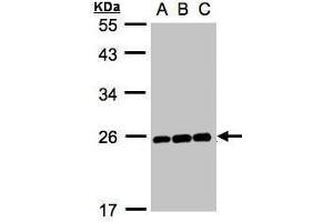 MAD2L1 Antikörper（C术语）