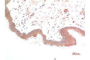Immunohistochemical analysis of paraffin-embedded Human Skin Tissue using Phospho-Smad3(S425) Mouse mAb diluted at 1:200. (Phospho-SMAD3(S425) (pSer425) Antikörper)