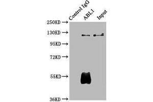 Immunoprecipitating ABL1 in Hela whole cell lysate Lane 1: Rabbit control IgG (1 μg) instead of ABIN7174001 in Hela whole cell lysate. (ABL1 Antikörper  (AA 4-194))