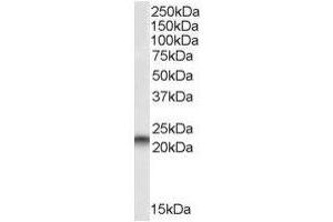 Image no. 2 for anti-Phosphatidylethanolamine Binding Protein 1 (PEBP1) (C-Term) antibody (ABIN374198) (PEBP1 Antikörper  (C-Term))