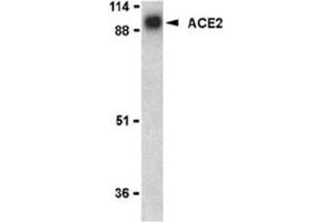 Image no. 2 for anti-Angiotensin I Converting Enzyme 2 (ACE2) (N-Term) antibody (ABIN319091) (ACE2 Antikörper  (N-Term))