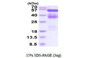 EPH Receptor B4 Protein (EPHB4) (AA 16-539) (His tag)