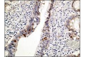 Image no. 1 for anti-Tumor Protein P53 (TP53) (N-Term) antibody (ABIN1494420) (p53 Antikörper  (N-Term))