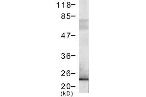 Image no. 1 for anti-DYKDDDDK Tag antibody (ABIN274245) (DYKDDDDK Tag Antikörper)