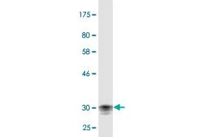 Western Blot detection against Immunogen (31. (Corneodesmosin Antikörper  (AA 306-355))