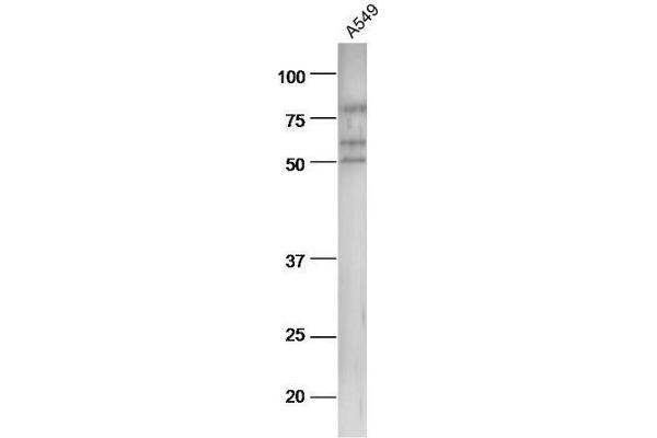 Cytokeratin 1 Antikörper  (AA 101-200)