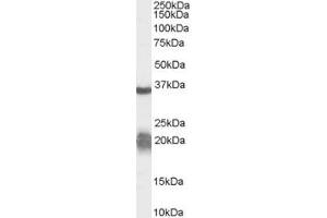Western Blotting (WB) image for anti-Family with Sequence Similarity 132, Member A (FAM132A) (N-Term) antibody (ABIN2791522) (FAM132A Antikörper  (N-Term))