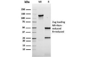 SDS-PAGE (SDS) image for anti-V-Akt Murine Thymoma Viral Oncogene Homolog 1 (AKT1) (AA 85-189) antibody (ABIN6939338)