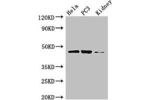Western Blot Positive WB detected in: Hela whole cell lysate, PC-3 whole cell lysate, Mouse kidney tissue All lanes: GSK3B antibody at 3 μg/mL Secondary Goat polyclonal to rabbit IgG at 1/50000 dilution Predicted band size: 47, 49 kDa Observed band size: 47 kDa (GSK3 beta Antikörper  (AA 1-420))