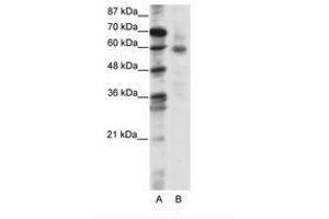 Image no. 1 for anti-Forkhead Box O1 (FOXO1) (N-Term) antibody (ABIN202855) (FOXO1 Antikörper  (N-Term))