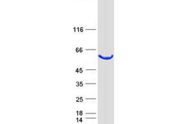 TBCE Protein (Transcript Variant 2) (Myc-DYKDDDDK Tag)