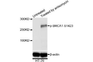 Western blot analysis of extracts of HT-29 cells,using Phospho-BRCA1-S1423 antibody (ABIN5969949) at 1/2000 dilution. (BRCA1 Antikörper  (pSer1423))