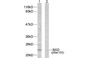 Western blot analysis of extracts from 293 cells using BAD (phospho-Ser155) antibody. (BAD Antikörper  (pSer155))