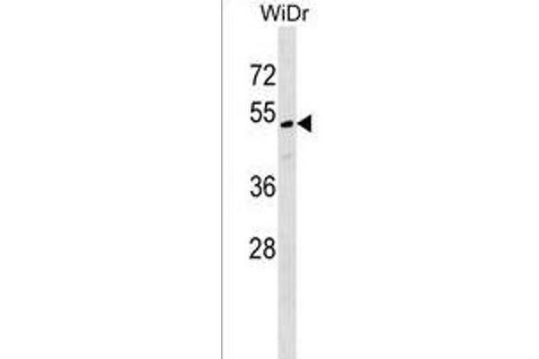 MLF1IP Antikörper  (C-Term)