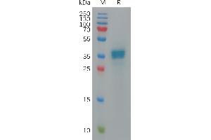 Human C Protein, hFc Tag on SDS-PAGE under reducing condition. (CXCL9 Protein (Fc Tag))