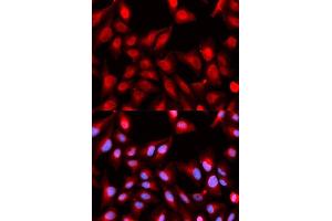 Immunofluorescence analysis of U2OS cells using DDX5 antibody. (DDX5 Antikörper)