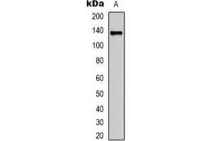Western blot analysis of Collagen 3 alpha 1 expression in Hela (A) whole cell lysates. (COL3A1 Antikörper)
