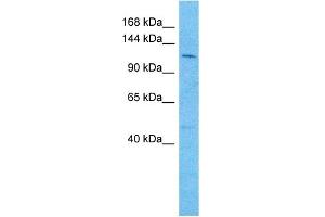 Host:  Rabbit  Target Name:  REST  Sample Type:  721_B Whole Cell lysates  Antibody Dilution:  1. (REST Antikörper  (N-Term))