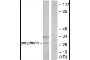 Western blot analysis of extracts from 293 cells, using PGP9. (UCHL1 Antikörper  (C-Term))