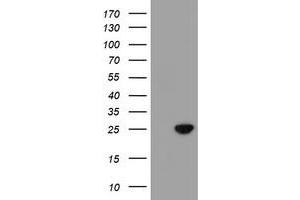 HEK293T cells were transfected with the pCMV6-ENTRY control (Left lane) or pCMV6-ENTRY C21orf56 (Right lane) cDNA for 48 hrs and lysed. (C21ORF56 Antikörper)