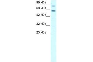 WB Suggested Anti-SND1 Antibody Titration:  1. (SND1 Antikörper  (N-Term))