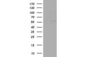 Image no. 1 for anti-Vimentin (VIM) (AA 210-466) antibody (ABIN1491202) (Vimentin Antikörper  (AA 210-466))