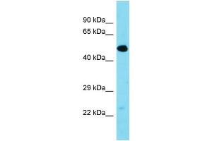 Western Blotting (WB) image for anti-Transmembrane Protein 39A (TMEM39A) (Middle Region) antibody (ABIN2500427) (TMEM39A Antikörper  (Middle Region))