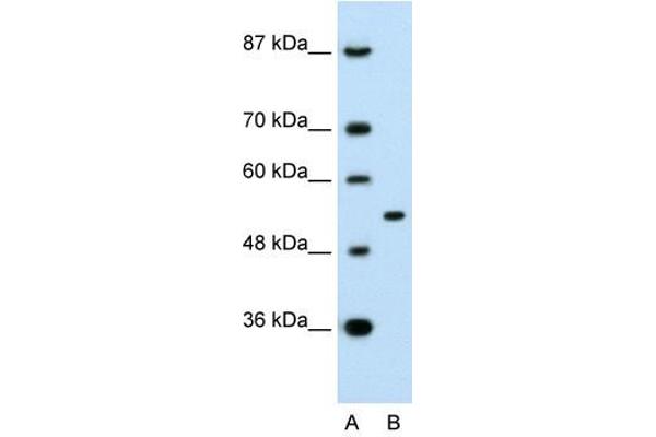 APBA1 Antikörper  (N-Term)