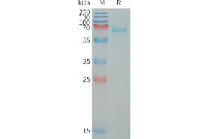 Human LI Protein, His Tag on SDS-PAGE under reducing condition. (LILRB5 Protein (AA 24-458) (His tag))