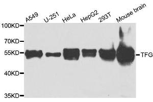 Western blot analysis of extracts of various cell lines, using TFG antibody. (TFG Antikörper  (AA 1-240))