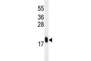 MCFD2 antibody western blot analysis in U251 lysate. (MCFD2 Antikörper)