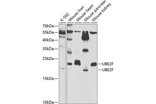 UBE2F Antikörper  (AA 1-185)